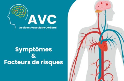AVC : FACTEURS DE RISQUES ET PRÉCAUTIONS